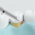 جرم گیر خانگی شیائومی مدل DR.BEI YC2 «اورجینال – ارسال 1 ساعت»